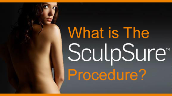 What is the SculpSure procedure?